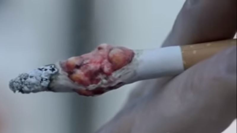 Sigaret met kankergezwel